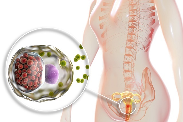 Chlamydia trachomatis