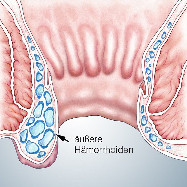 Intimbereich geburt schwangerschaft aussehen nach Vagina nach